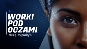 co oznaczają worki pod oczami sińce wokół oczu