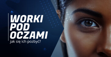 co oznaczają worki pod oczami sińce wokół oczu