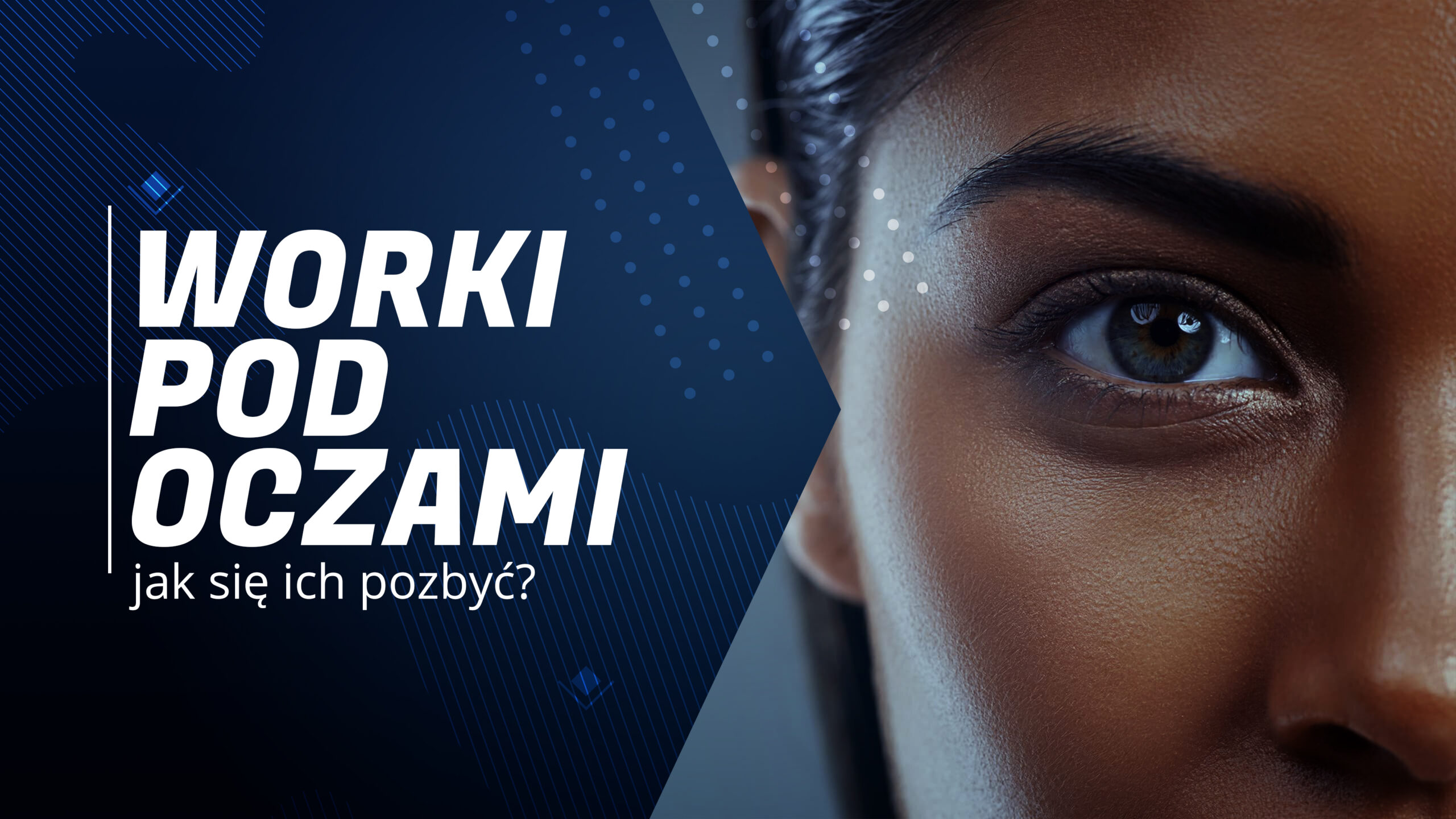 co oznaczają worki pod oczami sińce wokół oczu